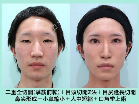 https://upload.hkgolden.media/comment/3bdiltiq.434jh4unnuw.f0yuy1q31mx.25y.jpg