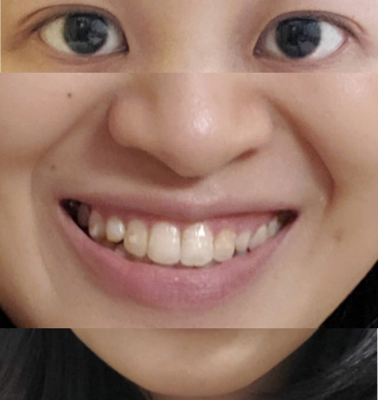 https://upload.hkgolden.media/comment/k21btmv2.ssjhc1tve5g.f1jxbfd5nbp.51b.jpg