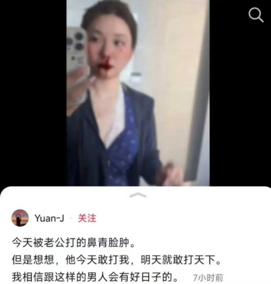 https://upload.hkgolden.media/comment/kywjxj2v.ozdhrnlugdg.4v5ewmcvdr5.hwb.jpg