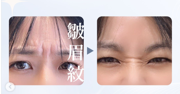 https://upload.hkgolden.media/comment/qvizjwsk.olhra1cydtf.lgouhuvxnof.aki.png
