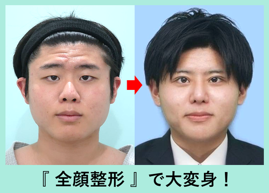 https://upload.hkgolden.media/comment/sw1q21to.jhnw2zundyj.mpeklfkax4u.bug.png